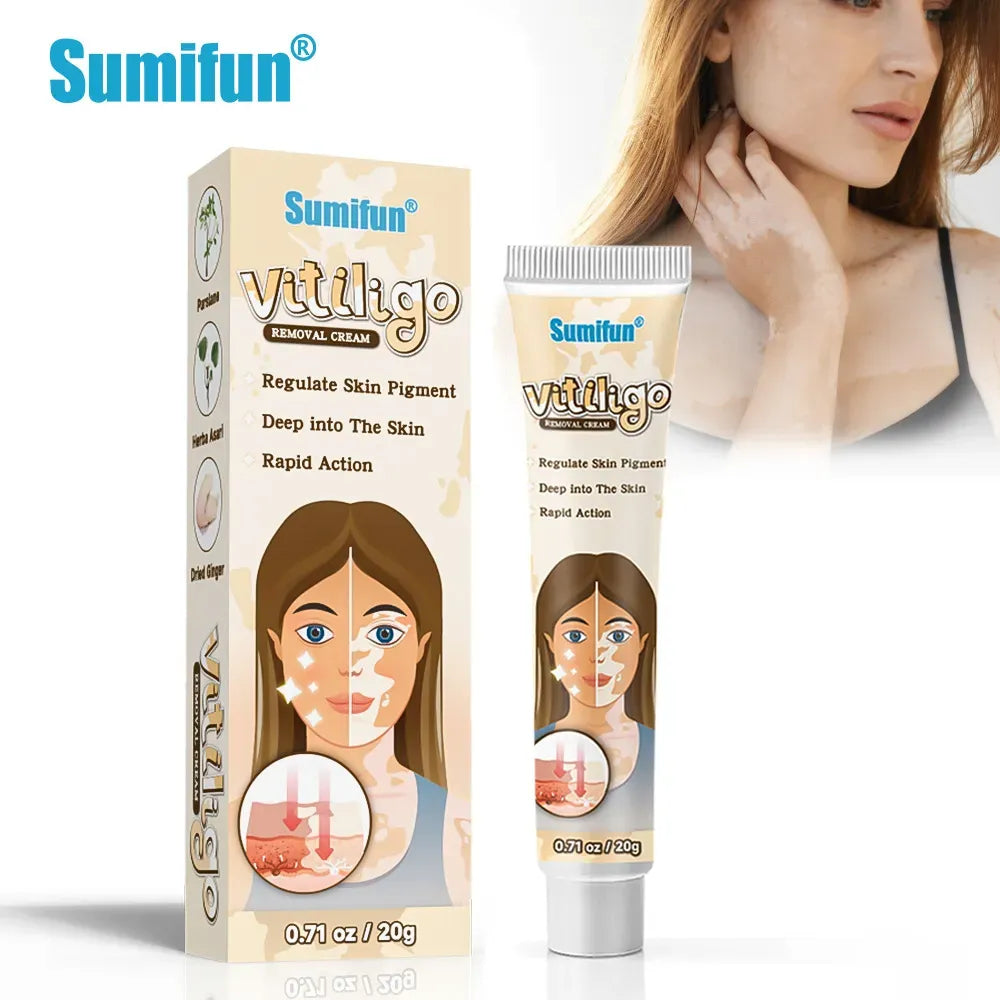 BeautyOne Vitiligo Removal Cream vitiligo skin treatment