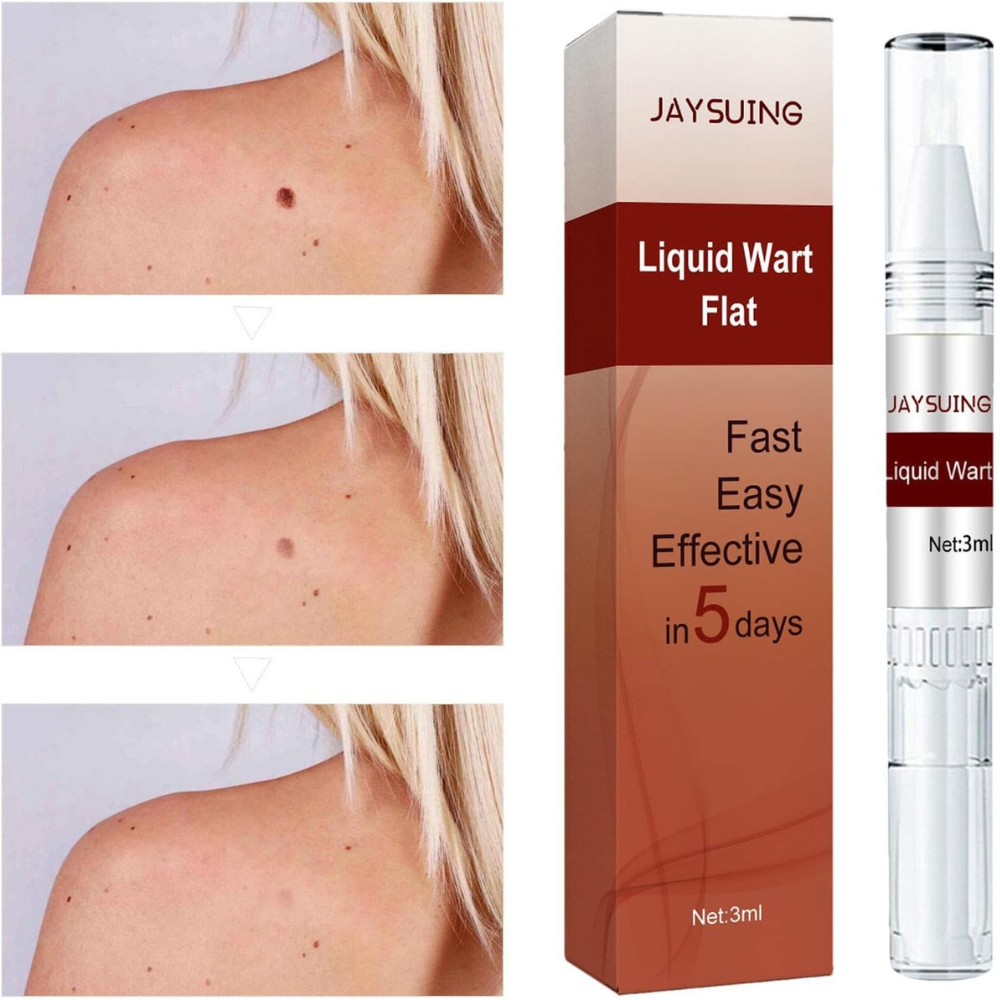 Liquid Wart and Skin Tag Removal