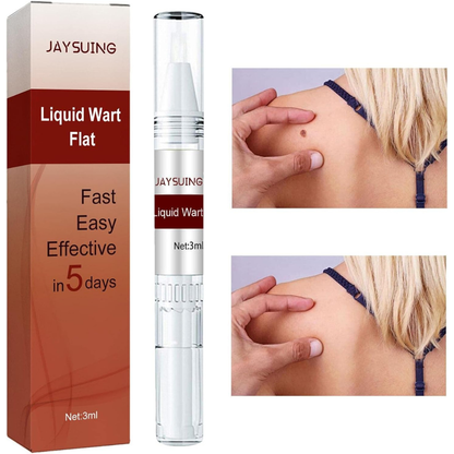Liquid Wart and Skin Tag Removal