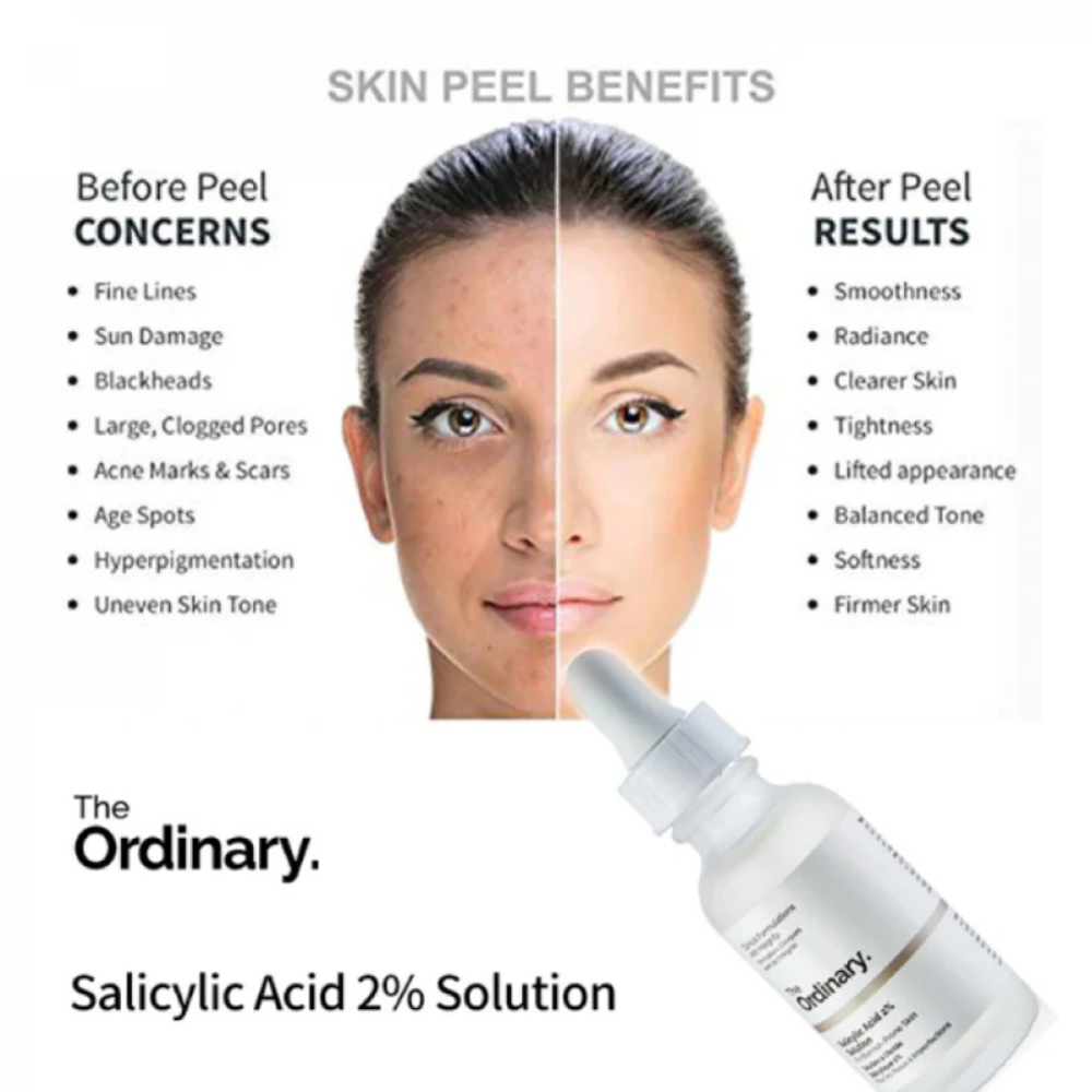 The Ordinary Serum Niacinamide 10% + Zinc 1% 30ml