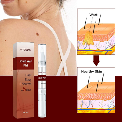 Liquid Wart and Skin Tag Removal