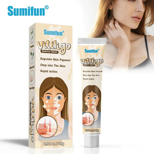 BeautyOne Vitiligo Removal Cream vitiligo skin treatment